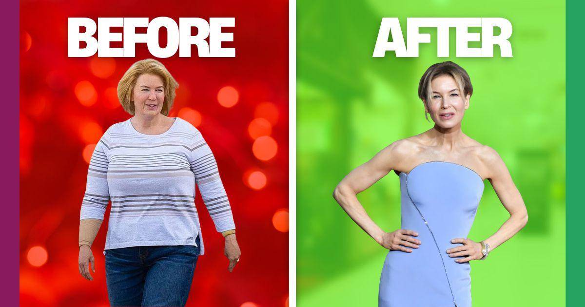 Shocking Celebrity Weight Transformations – Before & After Photos